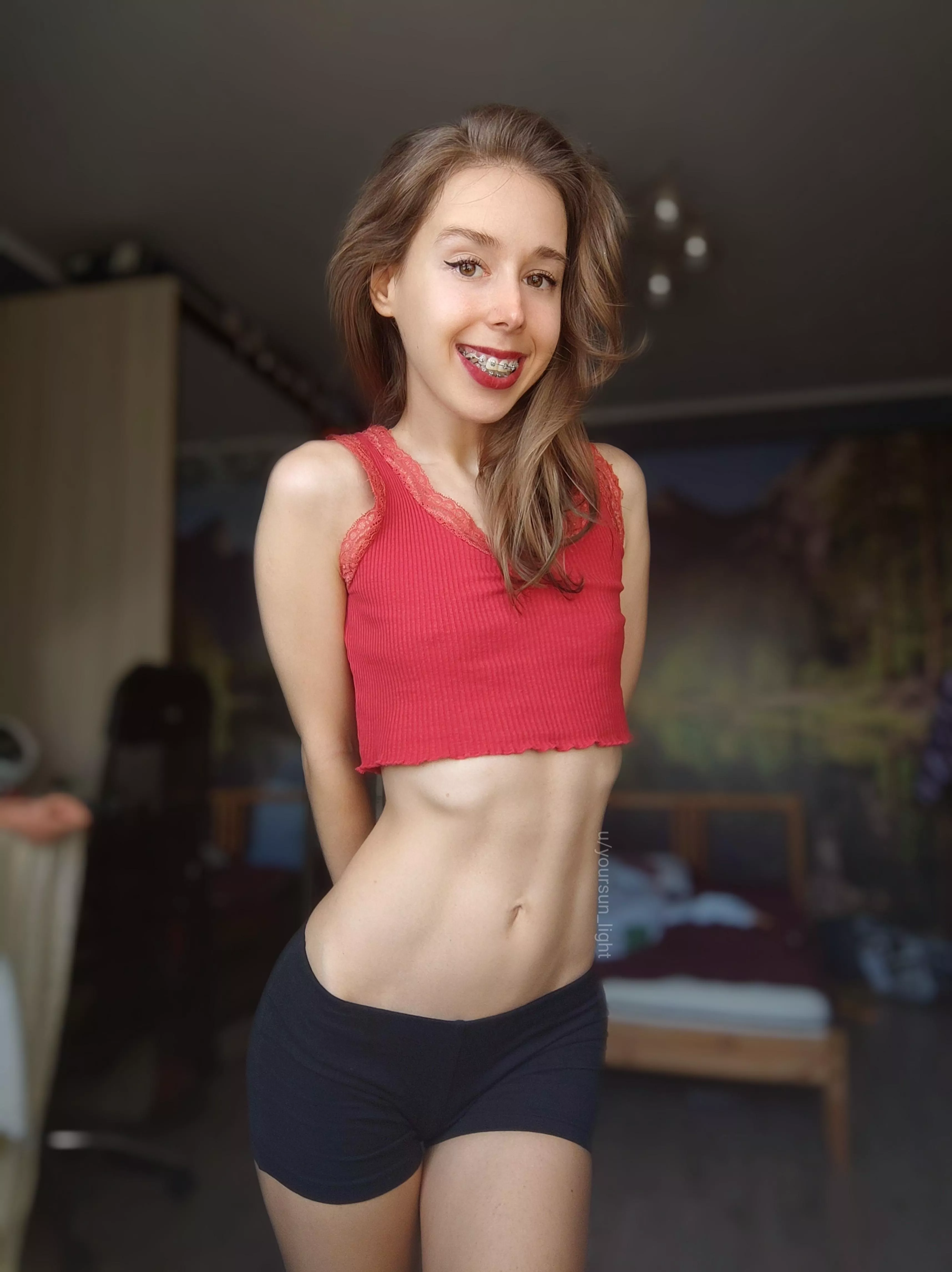 F21 Braces and red lipstick are a good combination, am I right? posted by yoursun_light