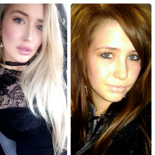 Facial b7mbofication progress??? by whamexcept