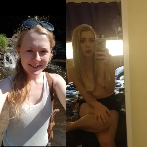 Feel like a new girl aws booked for more filler this week but I haven't had enough shifts to cover the costs by amuckbomb