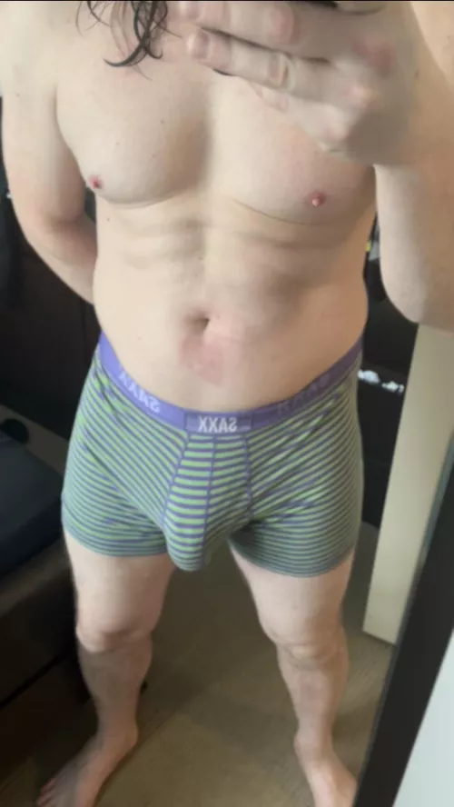 Feeling self conscious about my burn😢 by ozzyauxchord