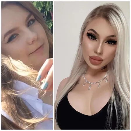 fillers and fake boobs😈💋 my bimbofication🔥 by charlotteventurax