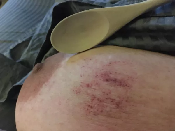 🍃 Finally found something to do with these awful things… (no misgendering: not a woman) by transmascT4T812