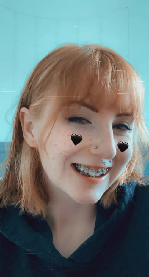 Finally got my braces!! by juliexlove