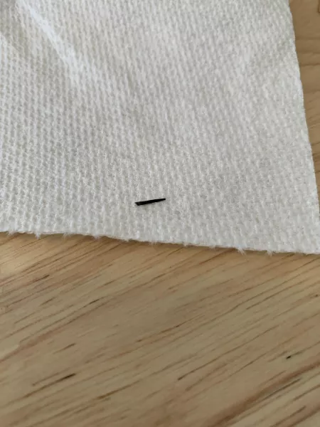 Finally out! Sea Urchin spine stuck in big toe for over 2 months! by ISCllc2