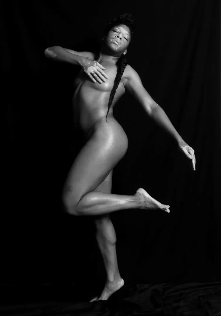 First Post here! As a woman with vitiligo, I love expressing myself through artsy nude photoshoots! I hope you like my image, and I’ll continue to post more 🙏🏾 posted by IzzyP_themodel
