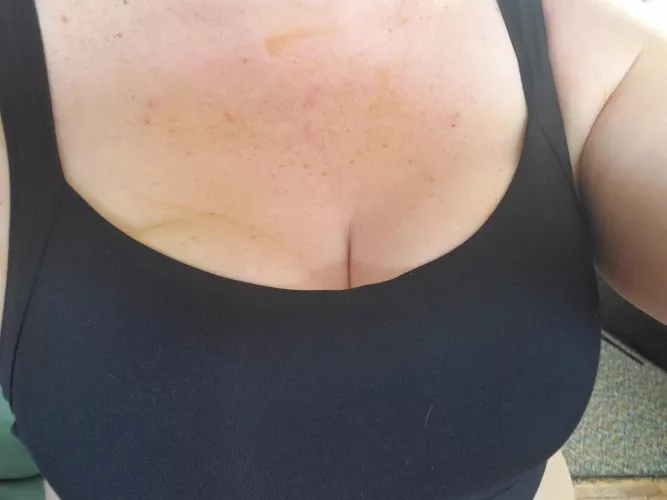 First time back in a sports bra after reconstruction by FairelyWench