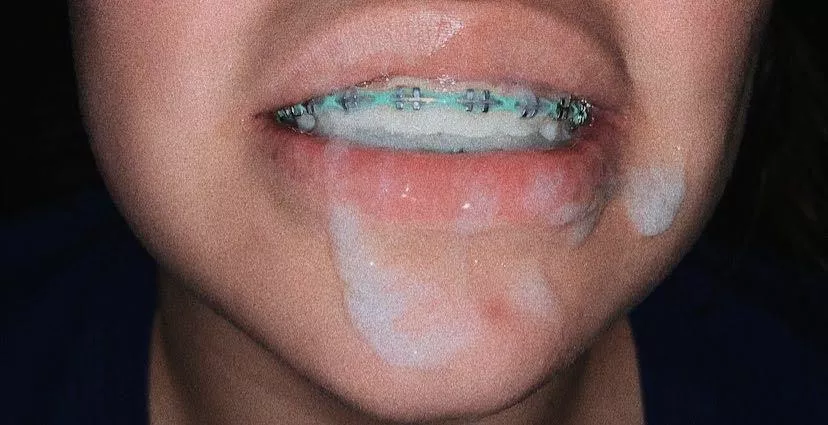 First time poster. Lmk if we should do more. posted by digbick2016