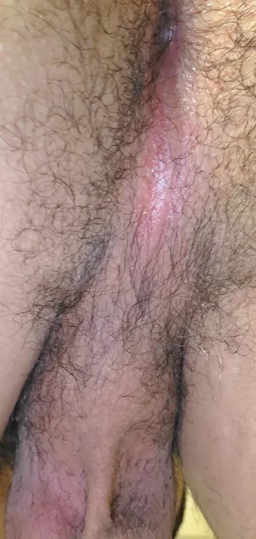 First time posting a taint pic should I do more by Humble_Tiger_1519