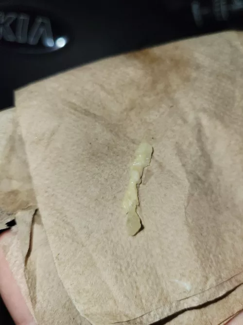 For the last while I've had a reoccurring blocked tear duct and pain. Well I just blew this out and had instant relief by jleesedz