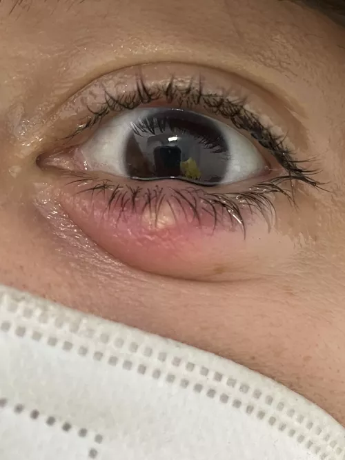 Forbidden (and quite painful) pop by fraupanda