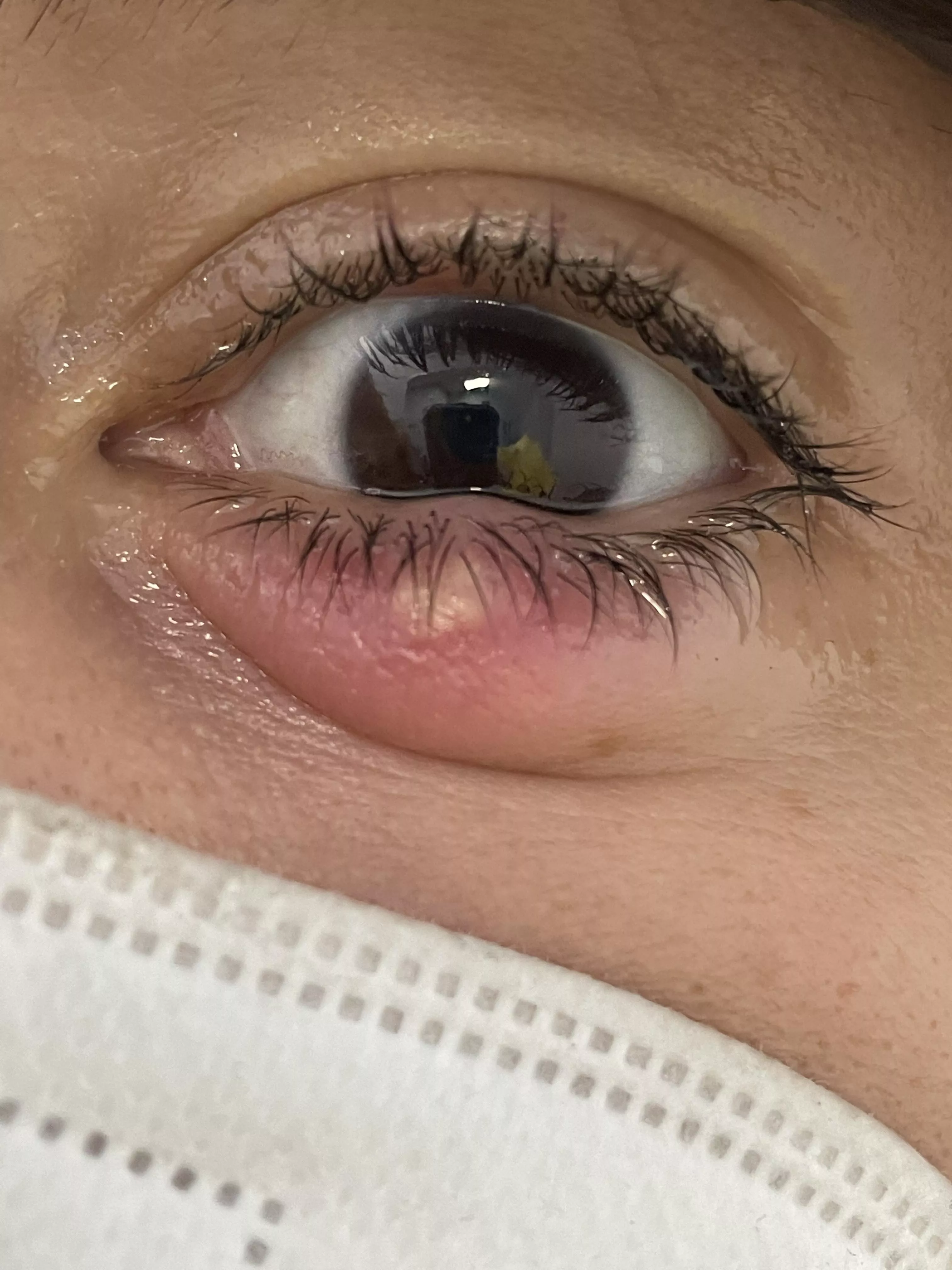 Forbidden (and quite painful) pop posted by fraupanda