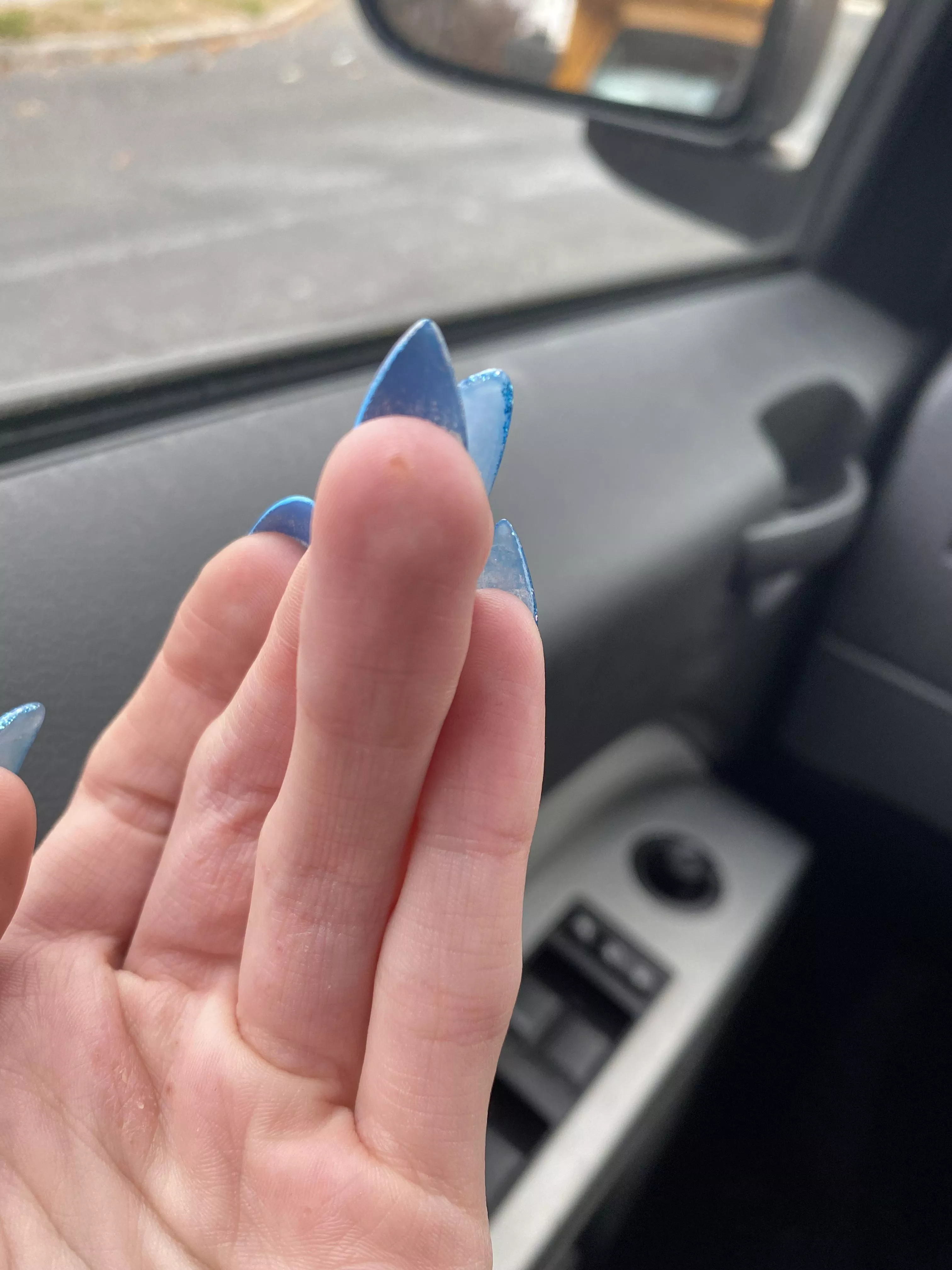 Forbidden pop. Dyshidrosis reminding me a flair up is just some stress away. posted by kkfluff