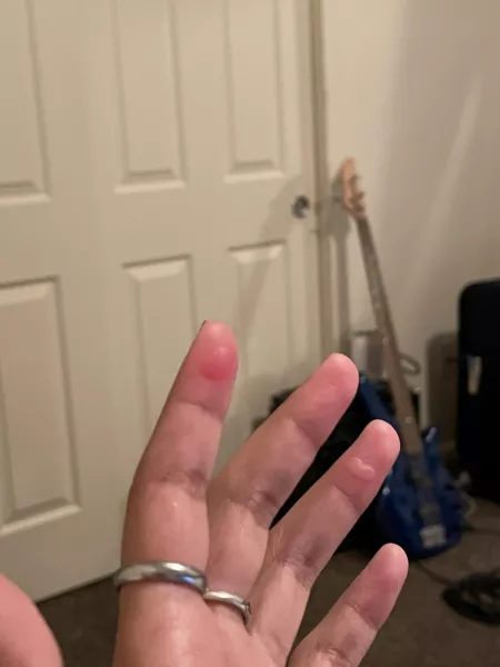 Forbidden pops and the cause by _xya_