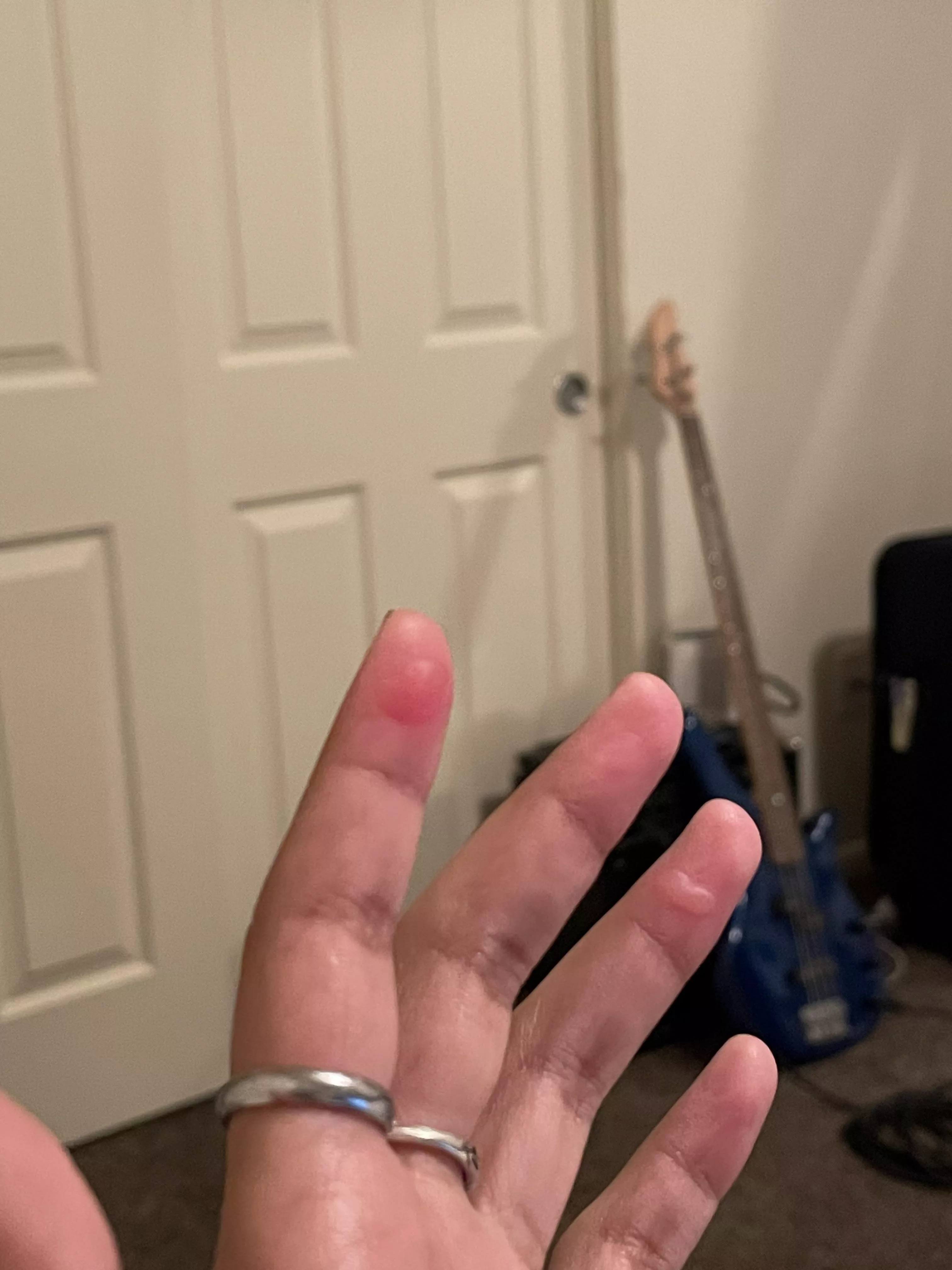 Forbidden pops and the cause posted by _xya_