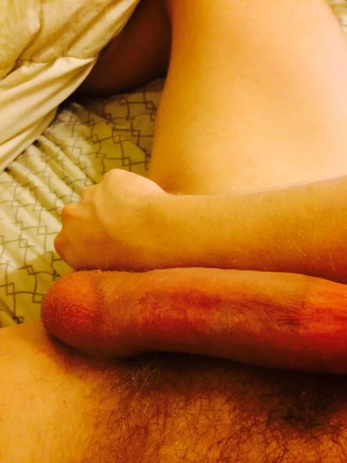 Forearm thick by Loud-Veterinarian718