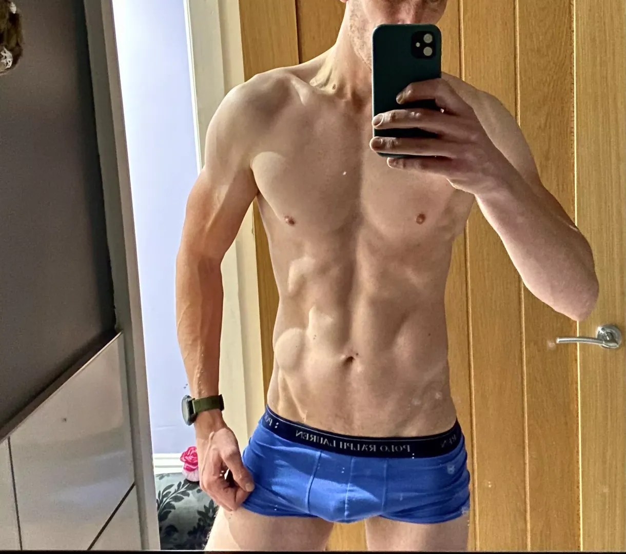 Forearm veins….plus a little extra posted by StandUpSayGoodbye