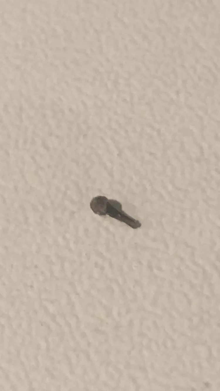Found this sharp hard thing inside a huge pimple/boil on my neck. What is it? posted by Corza000