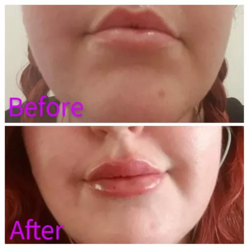 [F]oxie is starting her transformation.... by WolfandFoxie