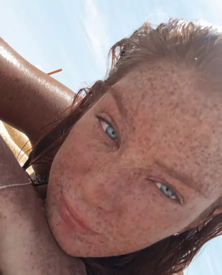 Freckle Face by perfidium2020