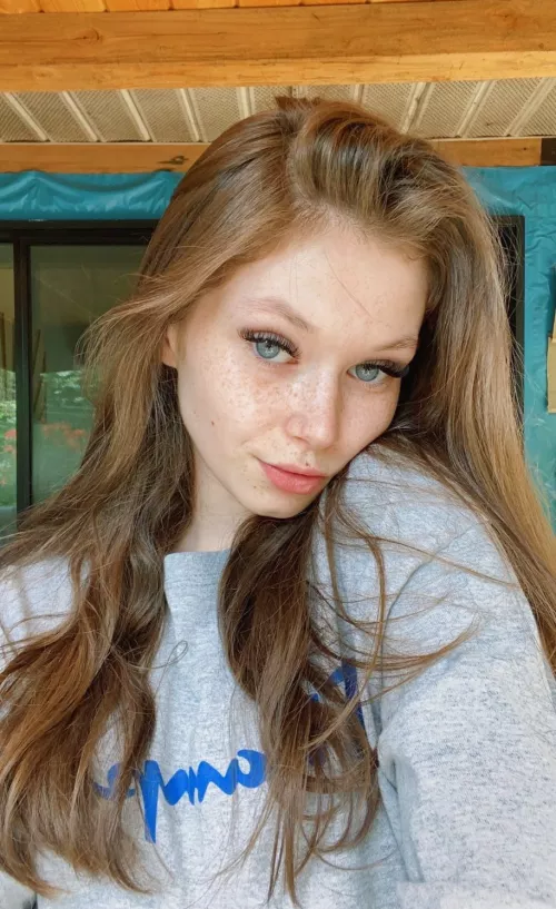 freckles by i_Repost69