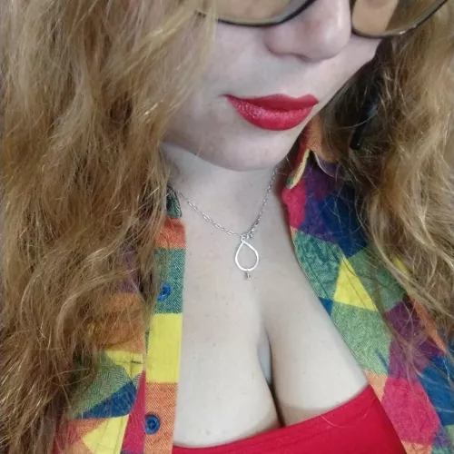 Freckles from head to toe 😉 by CherryPeaks