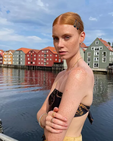 Freckles Ginger ♥️ by RoyalArtefakt