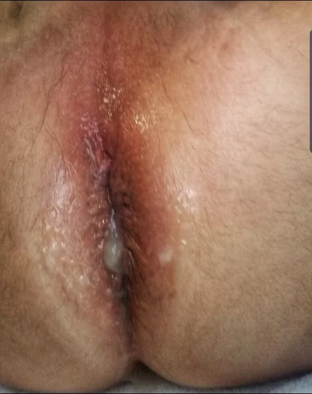 Freshly fucked hole. by gaystockylove