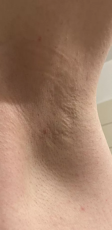 Freshly shaved and cleaned. Do you like it? 😛 by sunnypits