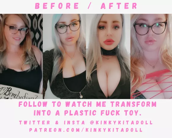 From my verification picture from last year to now. Getting more fillers next month, can't wait. 🥰 by KinkyKitaDoll