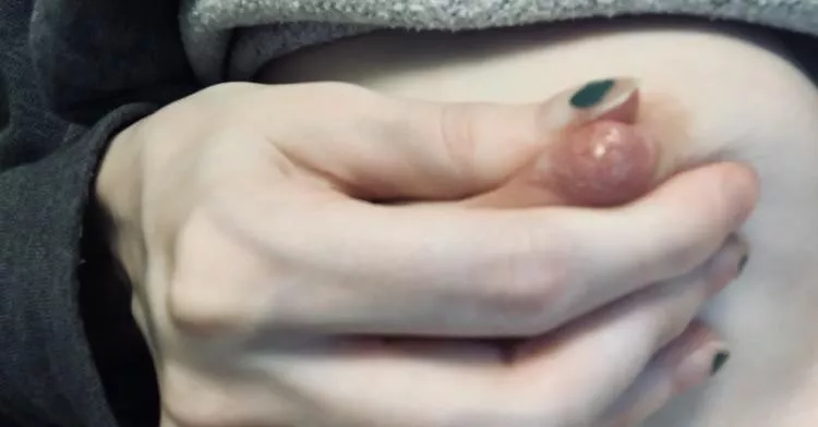 Ftm , 26 weeks pregnant and got my first leaking today 🤤😯 I was so surprised posted by Icexqueen22