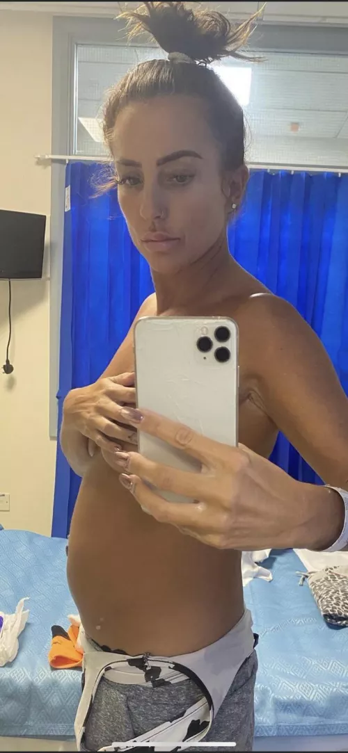 Full as an egg❤️ by Particular-Gene-9131