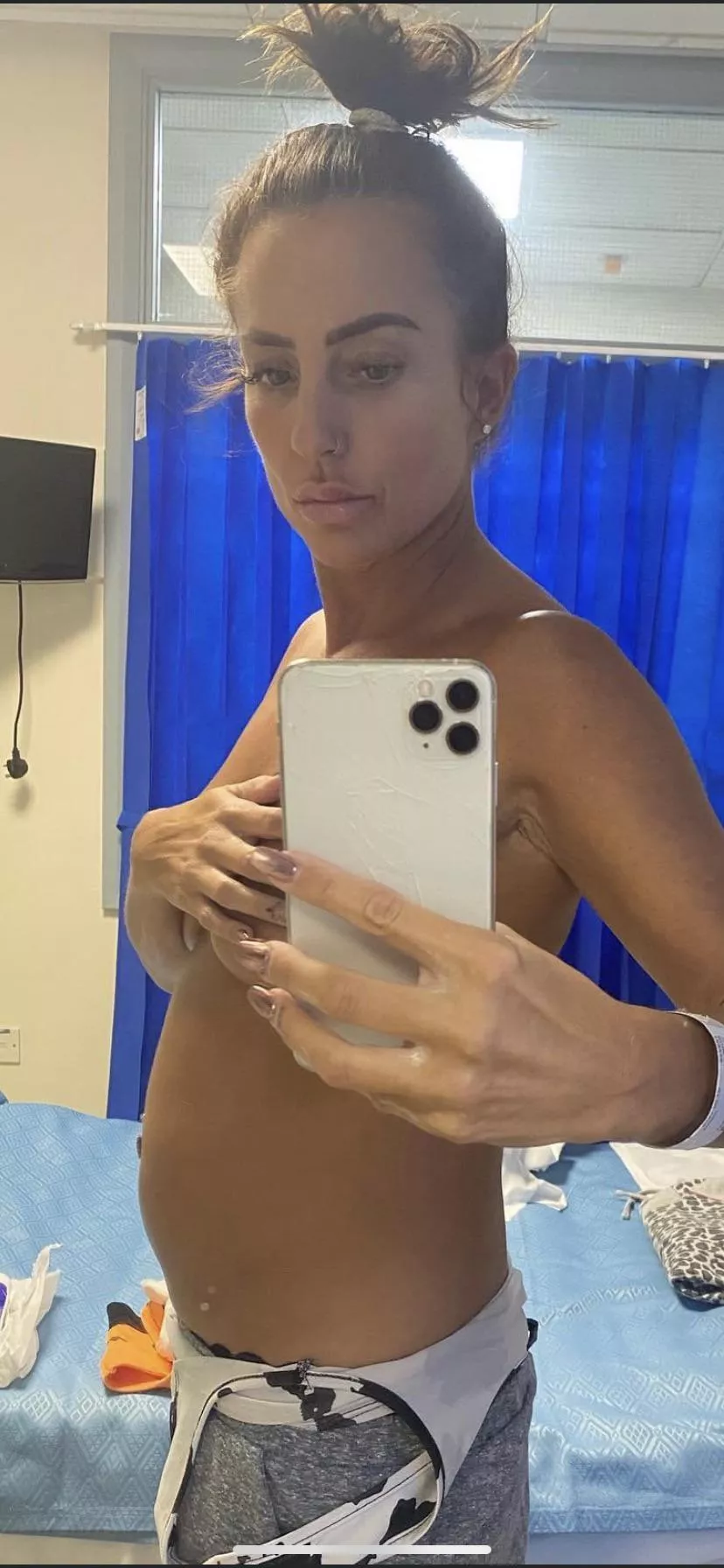 Full as an egg❤️ posted by Particular-Gene-9131