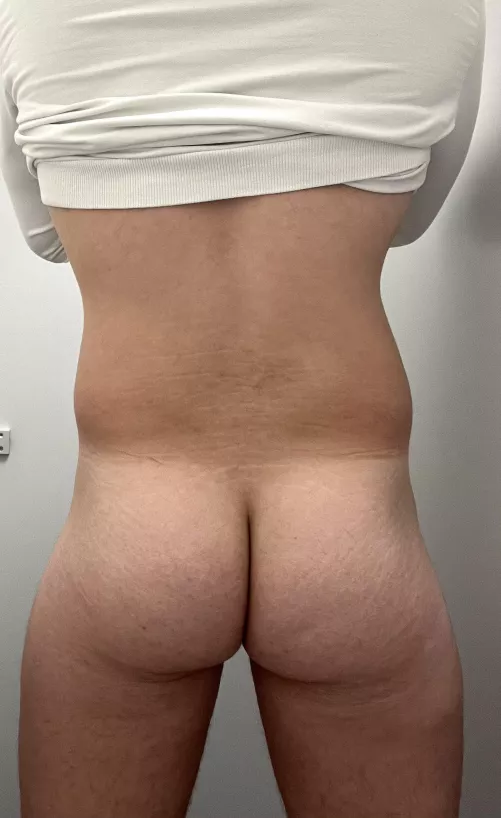 Getting fat… by 1R1B2