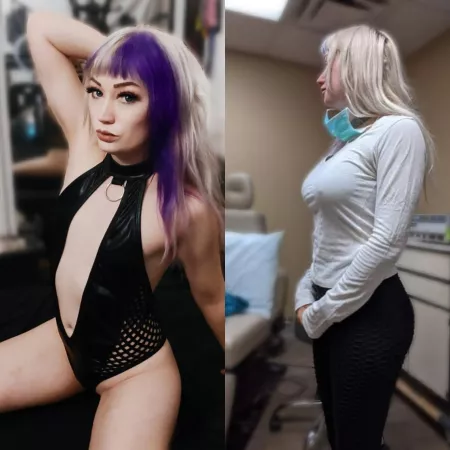 Getting my first surgery tomorrow! Left is before and right is the try on. by DahliaUndomiel