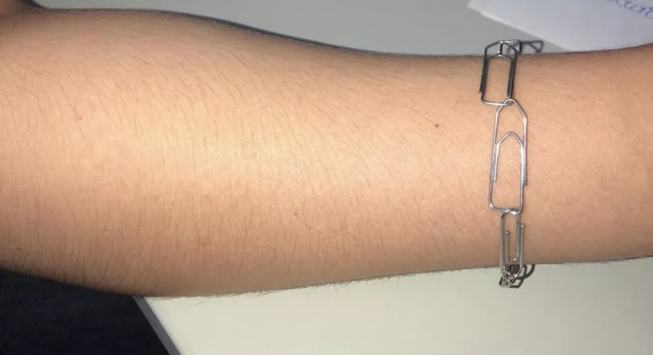 Gfs hairy arms by OneJuice1722