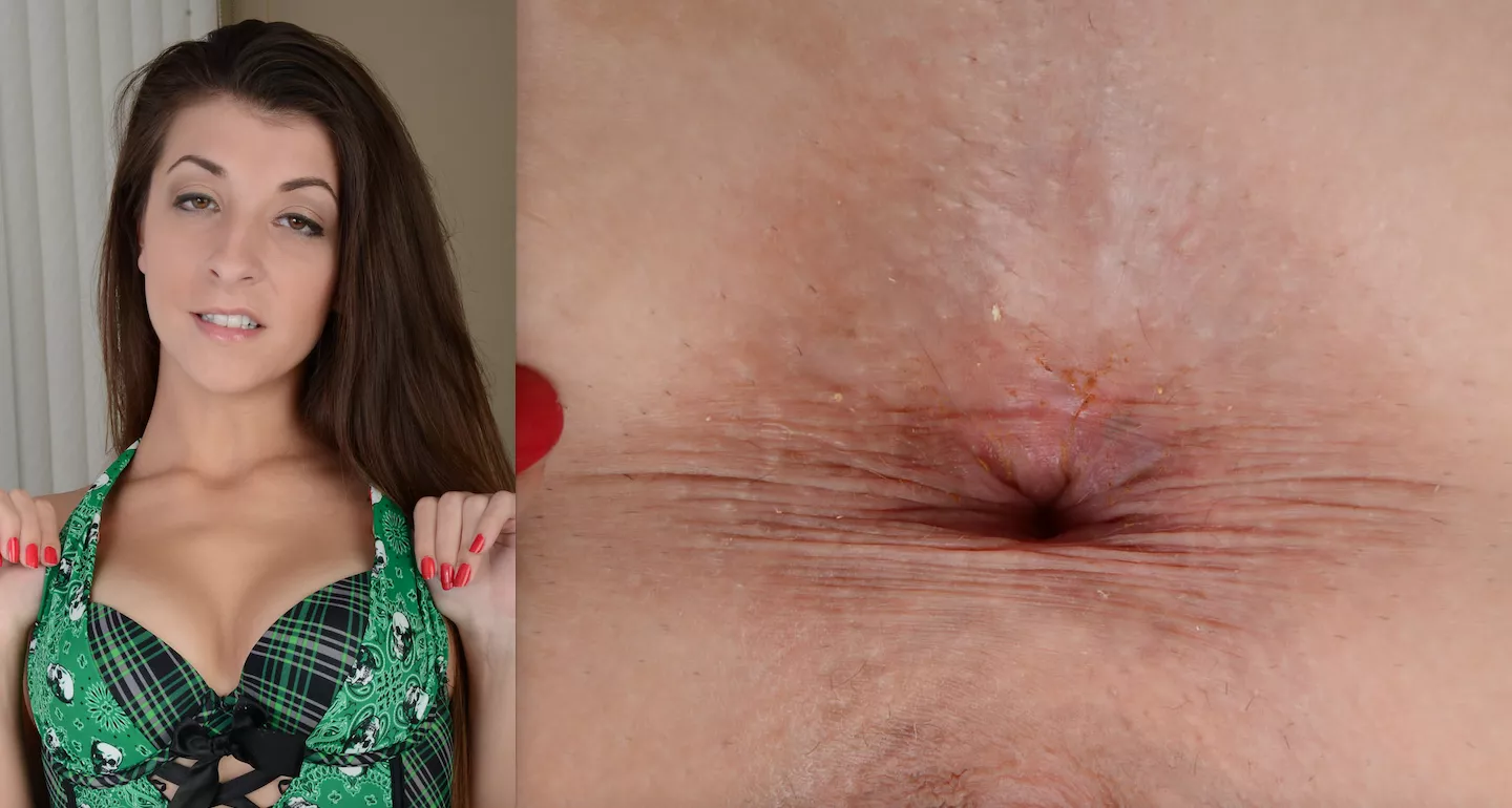 Giaoni Whiley's Asshole posted by alandoo