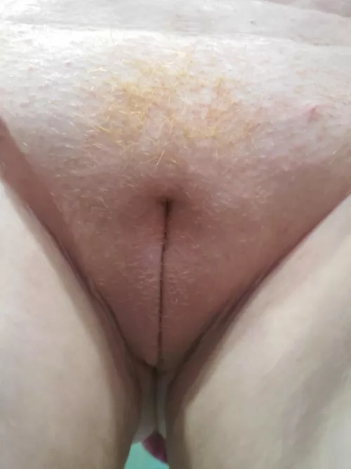 Ginger patch by fightingsilverback