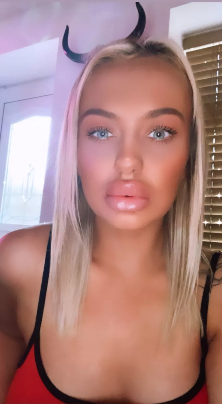 Glossy Big Lips posted by gosterime