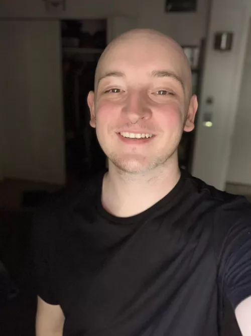 going bald in my teens really stunted my confidence and now idk how to talk to anybody 😭 by punyslicer