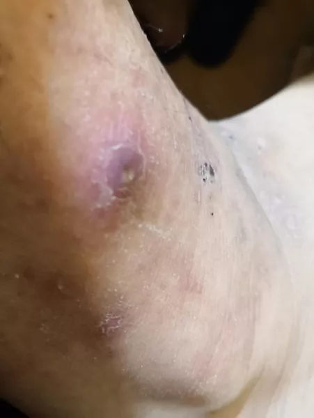 Going to the doctor tomorrow, this just randomly showed up by hiaussiemq