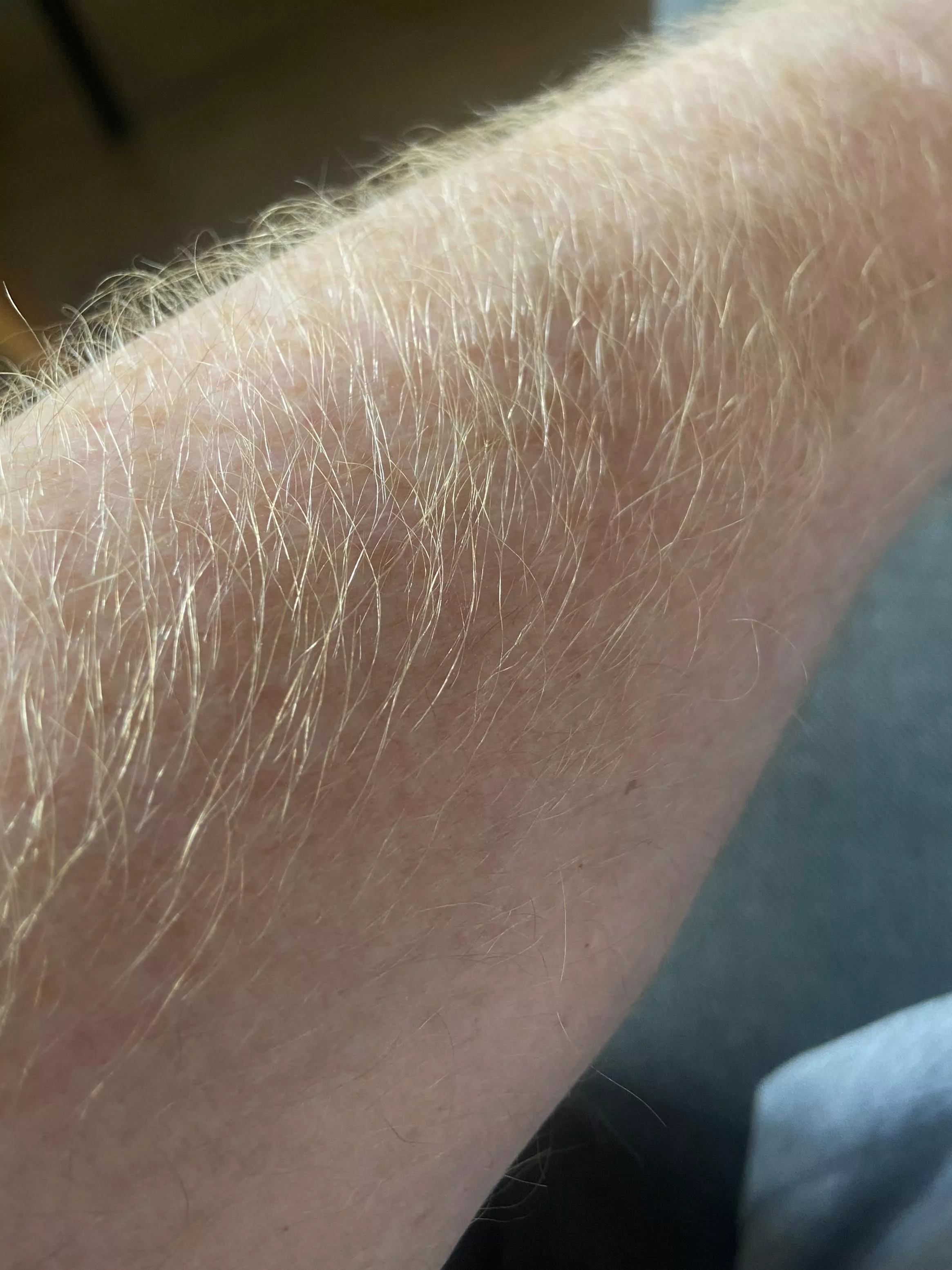 Good morning, here’s my ginger forearm for ya. posted by freeballfootyshorts