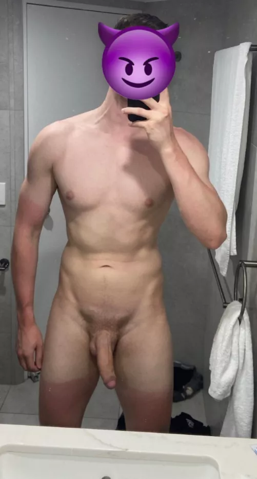 Got a bit burnt at the beach yesterday 😅 by itsalecccc