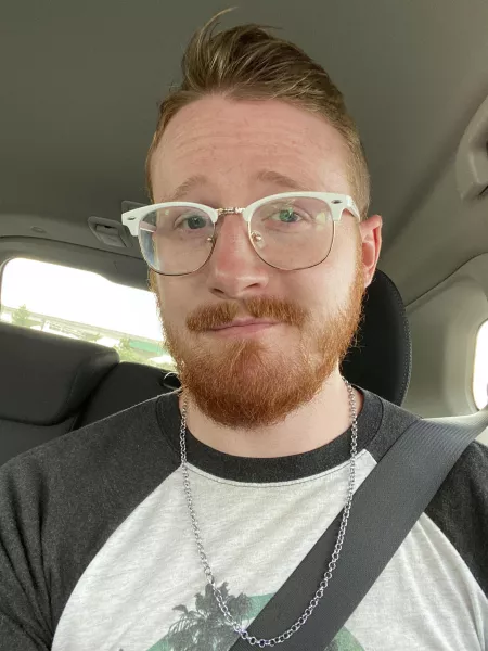 Got a tiny burn while in Florida by Kioseth