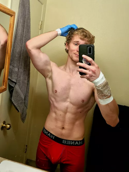 Got bit while saving a dog and now I have to find out the best way to shower like this. I could use a hand. by Canusgold22