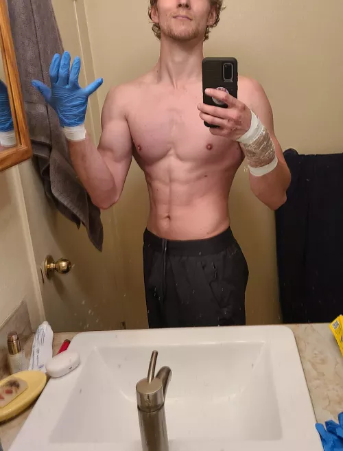 Got bit while saving a scared pup in the middle of the highway. Have to shower like this for the next few days. The dog is home safe now by Canusgold22