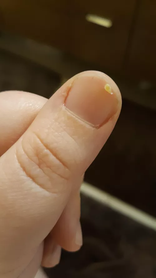 Got this big one out of my tummy the other day! by Cutie_Corgi