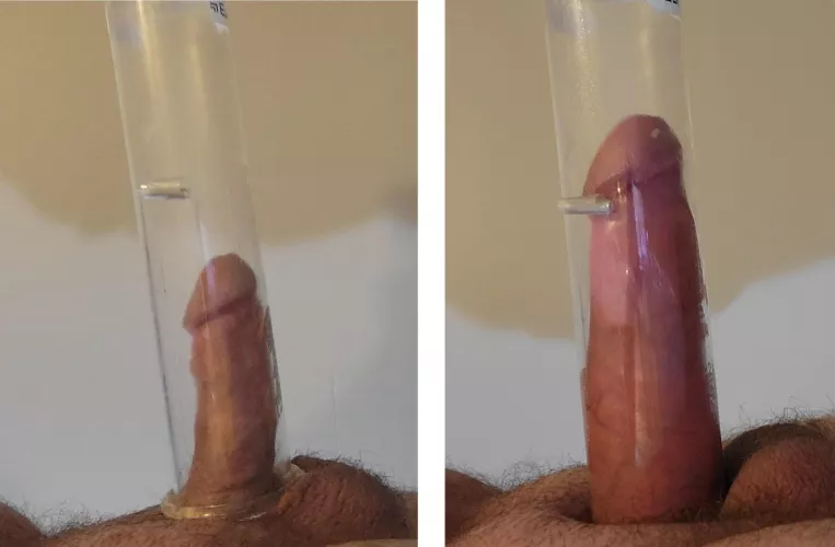 Growth by bittbigger