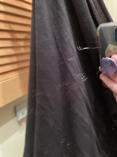 Had a monster cystic acne on my chin for 2 weeks now that refused to do anything and I tried to squeeze it on camera to no avail. The moment I tried to do it in the mirror this was the result. 2 cores came out. O_o (holding a shirt up so the camera would by xan_trippy