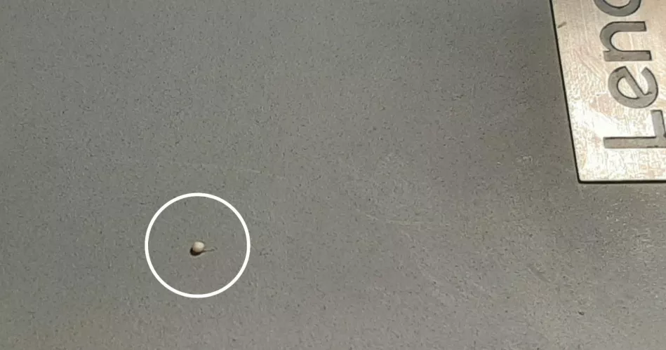 Had a painful Fordyce on by balls, popped one out and this little pebble came out. by Played62005