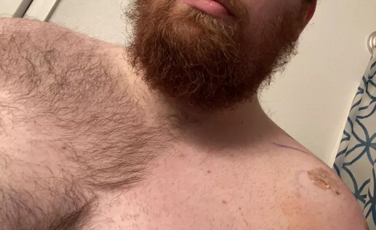 Had to have part of it shaved for surgery by bdc699